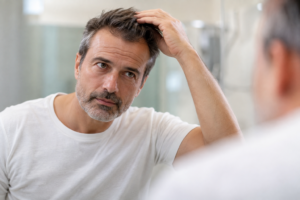 Cómo aumentar la densidad capilar con tratamientos médicos para mejorar el crecimiento del cabello